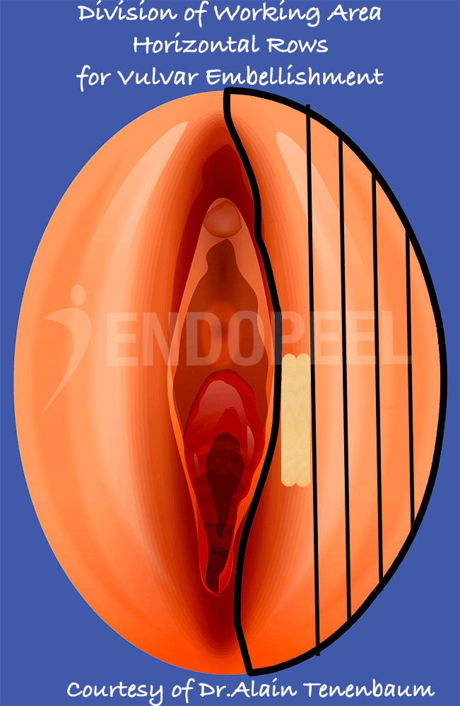 Horizontal-Division-vulvar-embellishment.gif