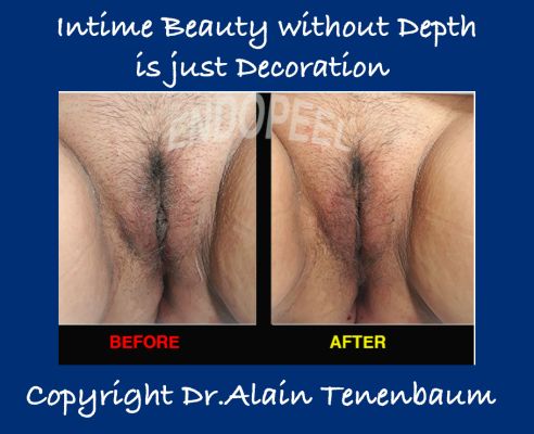 intime-beauty-without-depth