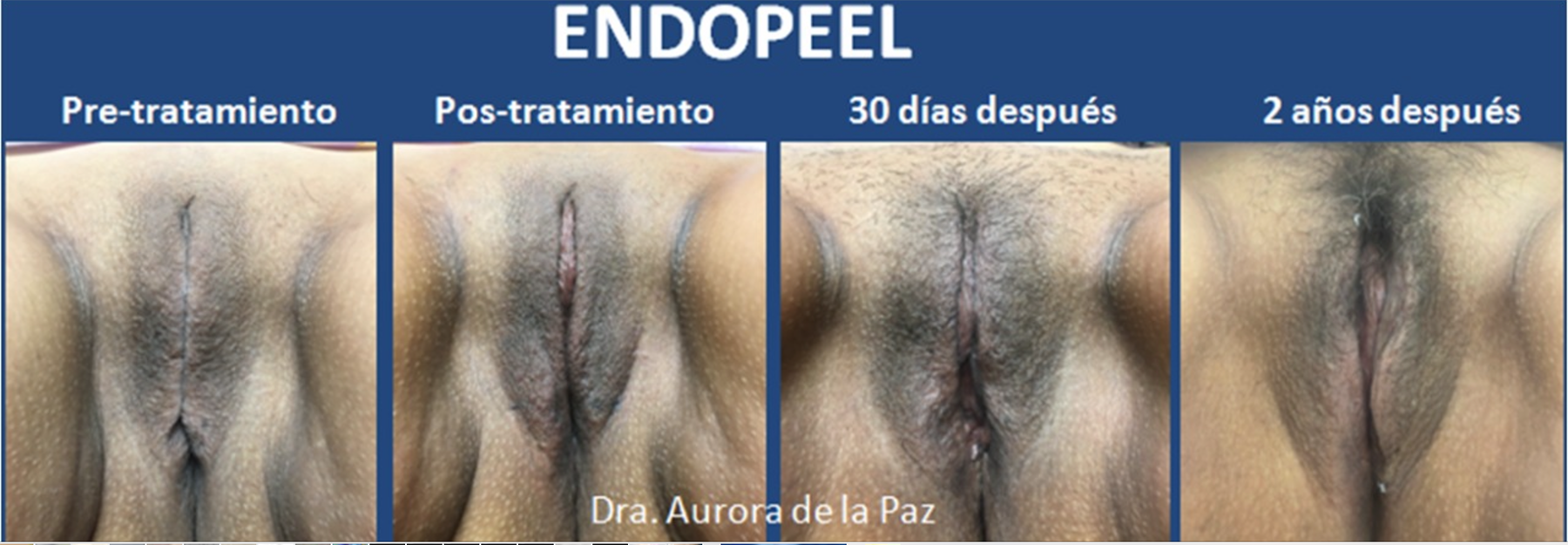 dra aurora de la paz on 2 years evolution